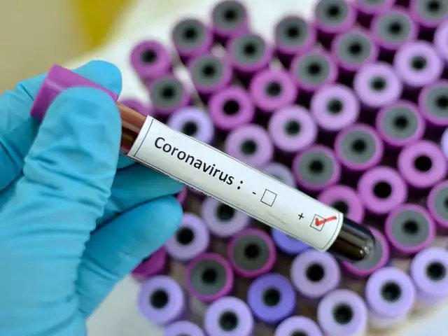 Bilanț coronavirus: 6.291 de cazuri noi de persoane infectate cu SARS – CoV – 2