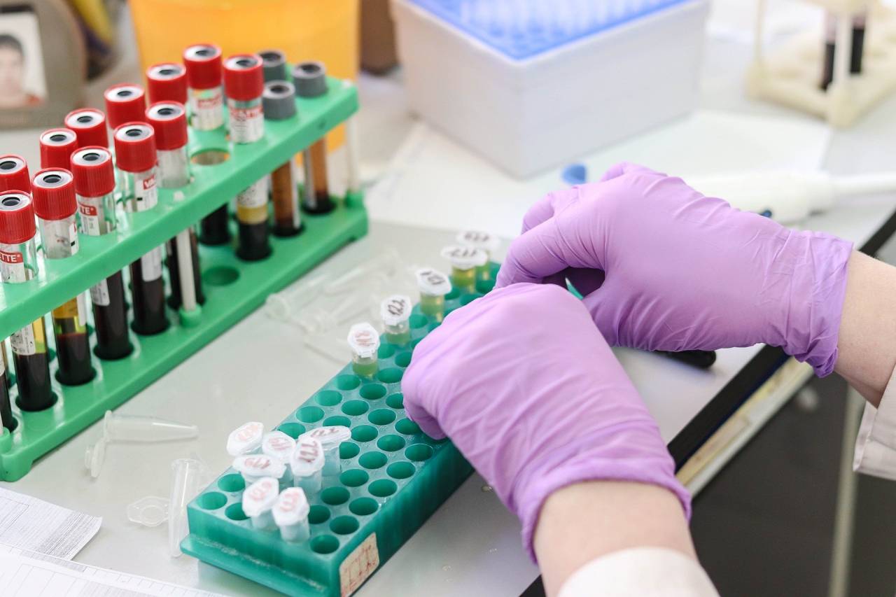 Au apărut testele PCR pentru detectarea variolei maimuței