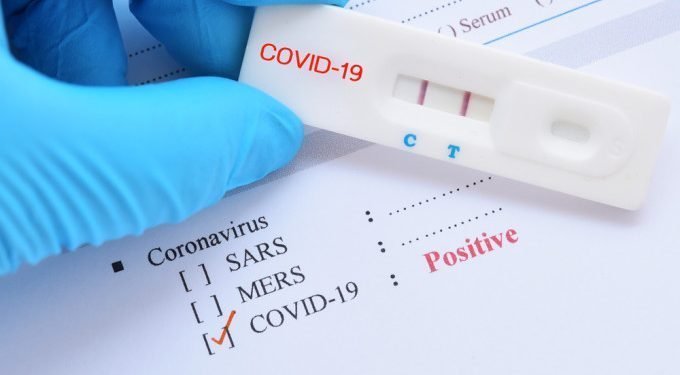 Testul pentru coronavirus care dă rezultatul în 15 minute