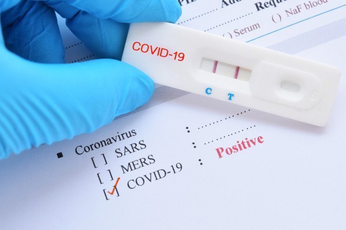 Un adolescent din România s-a reinfectat cu noul coronavirus