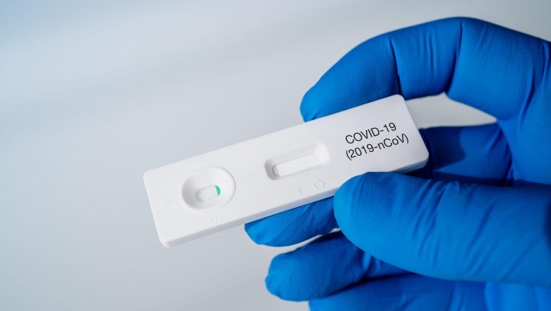 Covid-19. Un nou test mai rapid și ieftin pentru detectarea coronavirusului