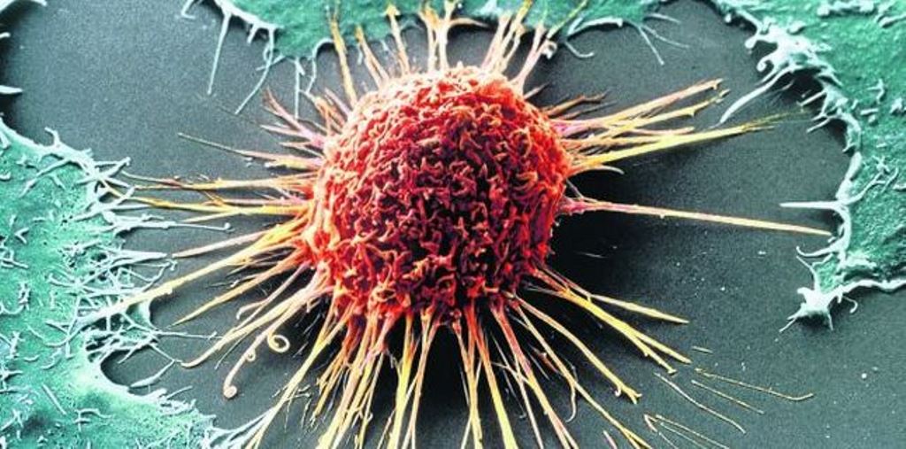 Uimitor: Celulele canceroase dezvoltă tentacule prin care absorb energia celulelor imunitare