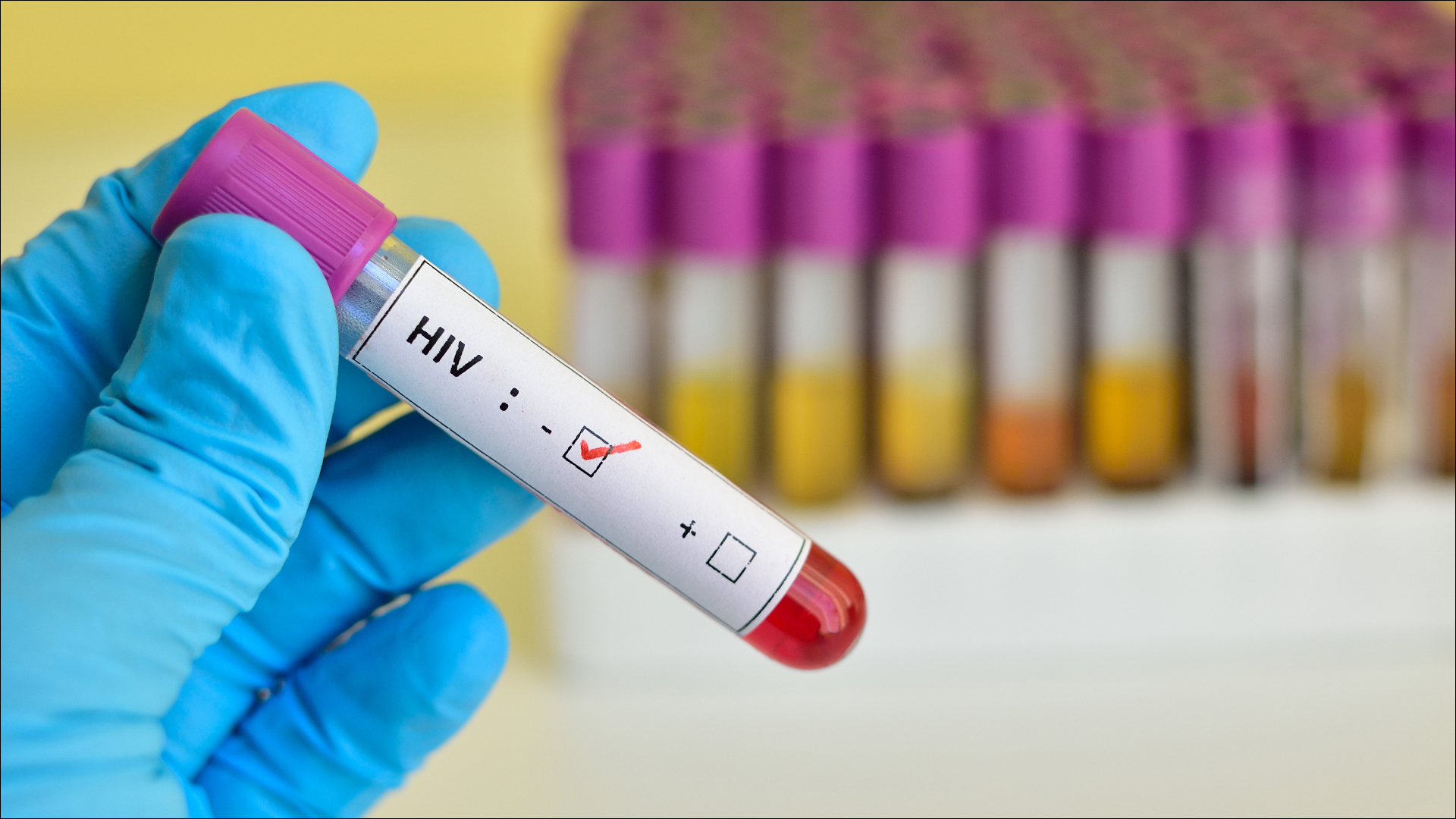科学者たちはHIVに対するワクチンを発見しました。免疫を獲得するには年に2回の注射が必要です